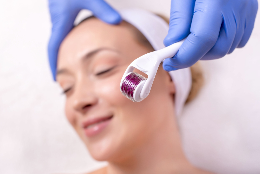 derma roll